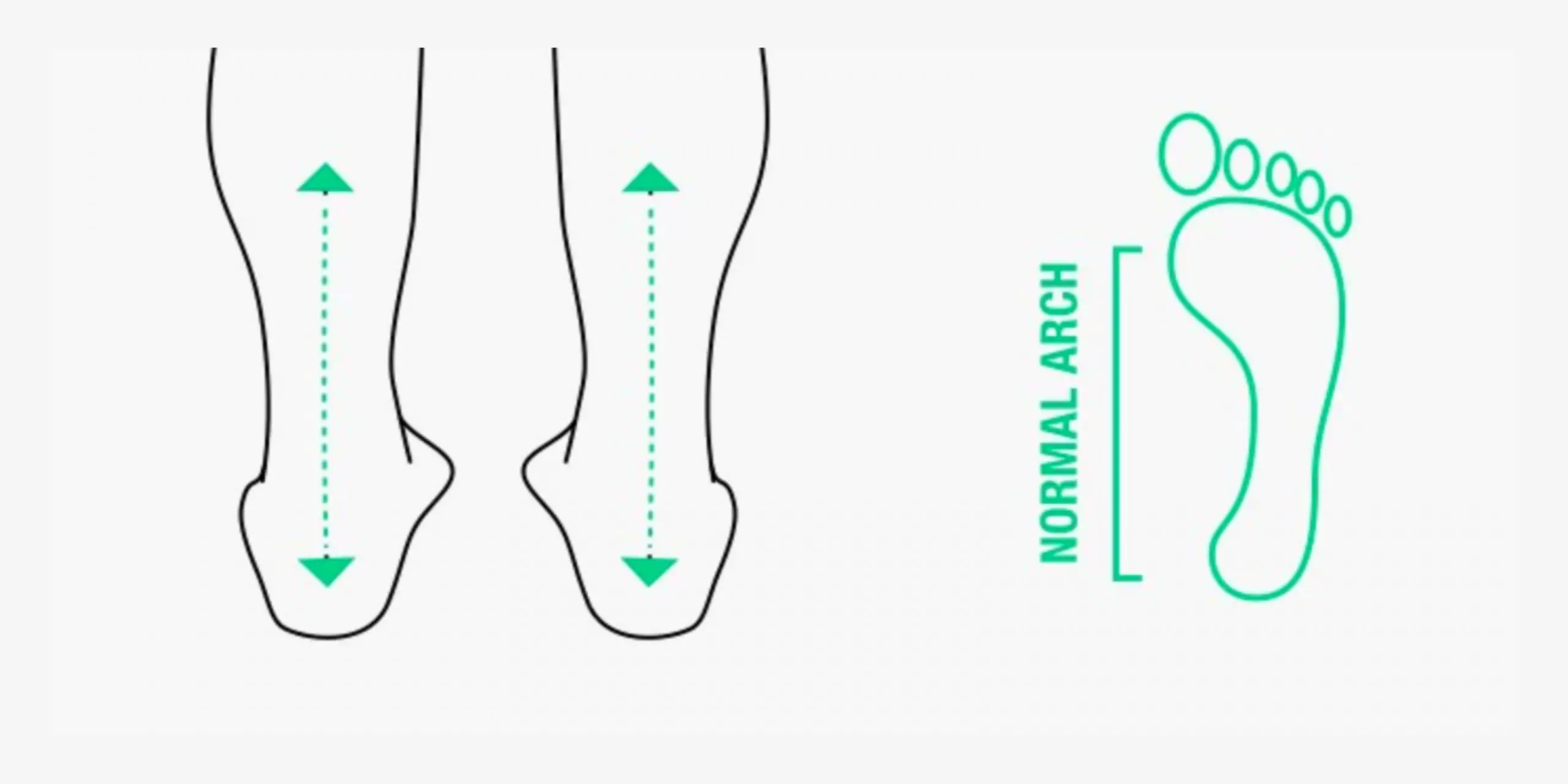 What's normal pronation