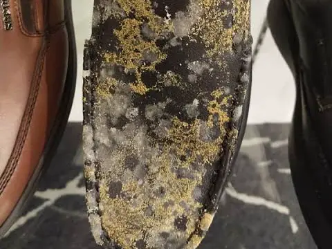 How to remove mold on shoes